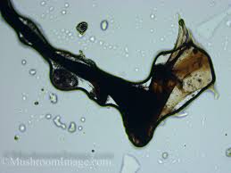 Attēlu rezultāti vaicājumam “Stemonitis axifera spores”