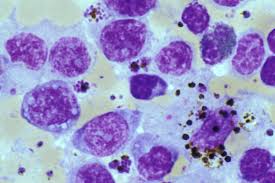 Attēlu rezultāti vaicājumam “Colloderma oculatum plasmodium”