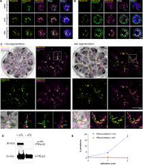 Attēlu rezultāti vaicājumam “Dianema depressum plasmodium”