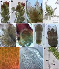 Attēlu rezultāti vaicājumam “Cephaloziella elachista macro”