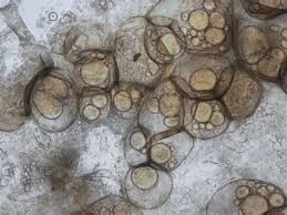 Attēlu rezultāti vaicājumam “Lycogala cf. fossiculatum sessile”