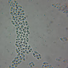 Attēlu rezultāti vaicājumam “Octospora splachnophila”