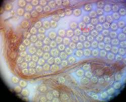 Attēlu rezultāti vaicājumam “Lycogala sphaeroconicum sessile”