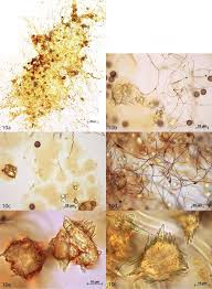 Attēlu rezultāti vaicājumam “Didymium tussilaginis sessile”
