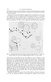 Attēlu rezultāti vaicājumam “Licea pusilla sessile”