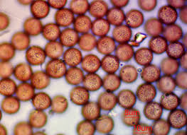 Attēlu rezultāti vaicājumam “Lycogala cf. oleocrystalliferum”