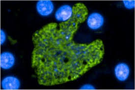 Attēlu rezultāti vaicājumam “Lignydium muscorum plasmodium”