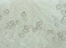 Attēlu rezultāti vaicājumam “Physisporinus vitreus”