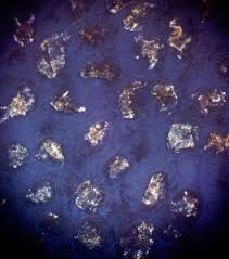 Attēlu rezultāti vaicājumam “Lycogala succineum”