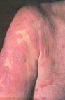 YourDoctor Dermatology Atlas