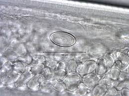 Attēlu rezultāti vaicājumam “Gulielmina vermicularis”