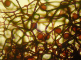 Attēlu rezultāti vaicājumam “Lamproderma ovoideum”