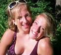 parapagus conjoined twins,