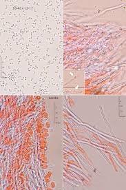 Attēlu rezultāti vaicājumam “Sidera lenis”