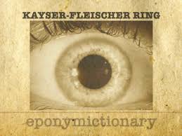 Kuvahaun tulos haulle Kayser-Fleischer