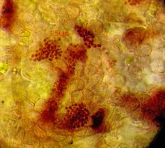 Attēlu rezultāti vaicājumam “Cribraria microcarpa spores”
