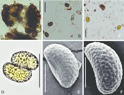 Attēlu rezultāti vaicājumam “Badhamiopsis macrospora spores”
