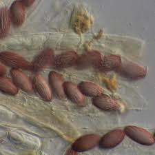 Attēlu rezultāti vaicājumam “Ascobolus furfuraceus”