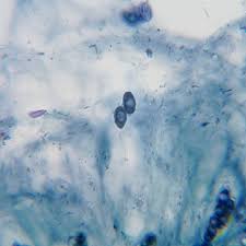 Attēlu rezultāti vaicājumam “Dermatocarpon miniatum”