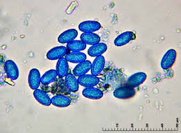 Attēlu rezultāti vaicājumam “Sowerbyella radiculata”