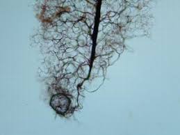 Attēlu rezultāti vaicājumam “Stemonitopsis hyperopta”