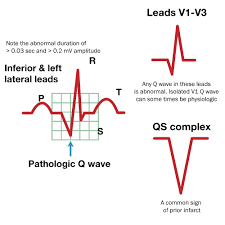 Image result for  v    q