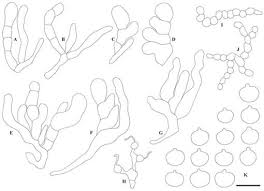Attēlu rezultāti vaicājumam “Biatoropsis usnearum”