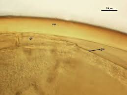 Attēlu rezultāti vaicājumam “Licea castanea spores”