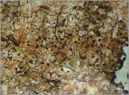 Attēlu rezultāti vaicājumam “Arthonia spadicea”