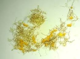 Attēlu rezultāti vaicājumam “Hemitrichia sordivesiculosa macro”