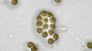 Attēlu rezultāti vaicājumam “Licea testudinacea spores”