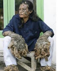 Image result for Lewandowsky-Lutz