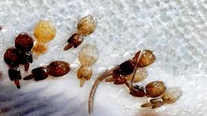 Attēlu rezultāti vaicājumam “Licea chelonoides spores”