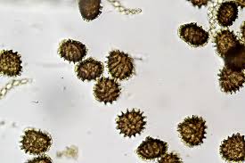 Attēlu rezultāti vaicājumam “Fossombronia wondraczekii spores”