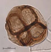 Attēlu rezultāti vaicājumam “Symphytocarpus trechisporus spores”