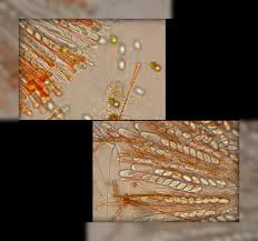 Attēlu rezultāti vaicājumam “Cheilymenia stercorea”