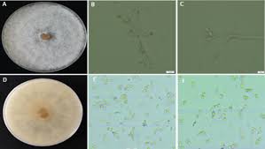 Attēlu rezultāti vaicājumam “Trichia botrytis spores”