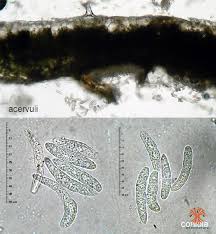 Attēlu rezultāti vaicājumam “Mycosphaerella ulmi”