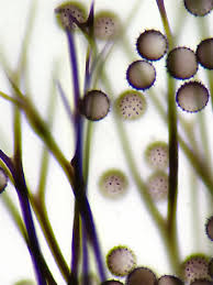 Attēlu rezultāti vaicājumam “Lamproderma pulchellum spores”