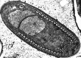 Attēlu rezultāti vaicājumam “Comatricha elegans var. microspora spores”