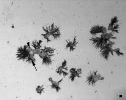 Attēlu rezultāti vaicājumam “Parmelia sulcata”