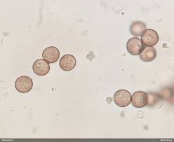Attēlu rezultāti vaicājumam “Diderma subincarnatum spores”