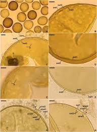 Attēlu rezultāti vaicājumam “Enteridium variabile spores”