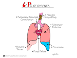 Six Ps of <b>Dyspnea</b>
