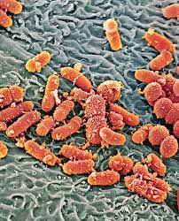 Attēlu rezultāti vaicājumam “Diderma simplex macro”