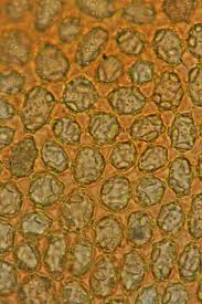 Attēlu rezultāti vaicājumam “Odontoschisma denudatum cells”