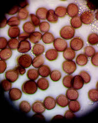 Attēlu rezultāti vaicājumam “Physarum oblatum spores”