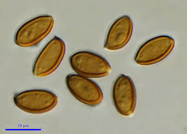 Attēlu rezultāti vaicājumam “Cribraria rubiginosa spores”