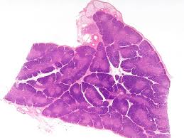 Image result for Thymus