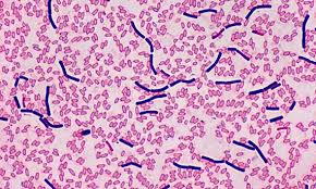 Attēlu rezultāti vaicājumam “Badhamiopsis praetermissa spores”